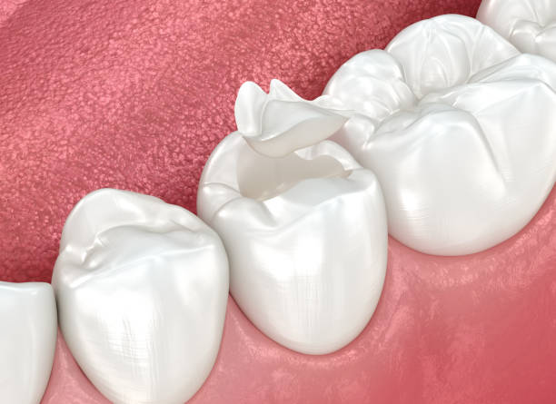 Best Dental Implants  in Grandville, MI